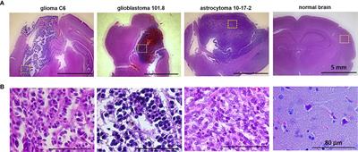 Label-Free Macroscopic Fluorescence Lifetime Imaging of Brain Tumors